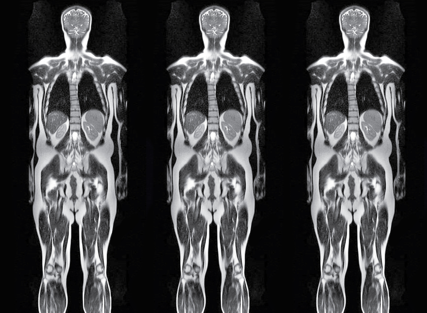 Whole Body MRI services at Nutex Health.